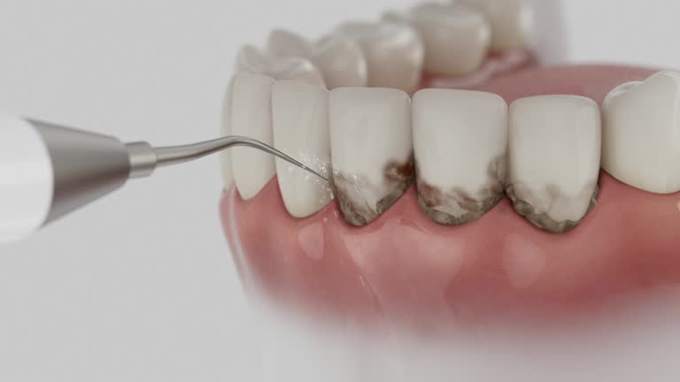 Trusted Teeth Cleaning And Checkup service in Ruckersville, VA - Dentist Open Now